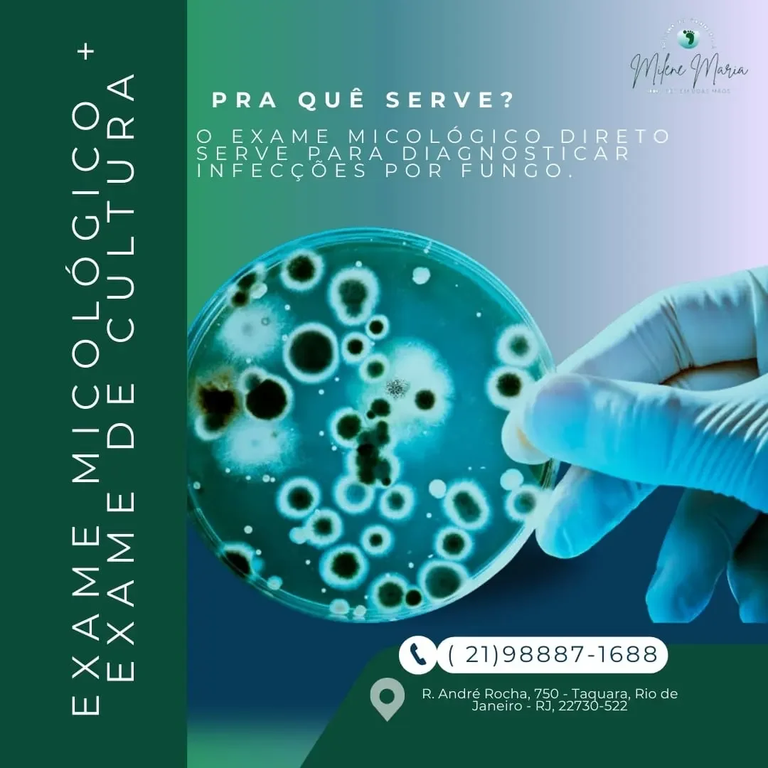 teste laboratorial de micose