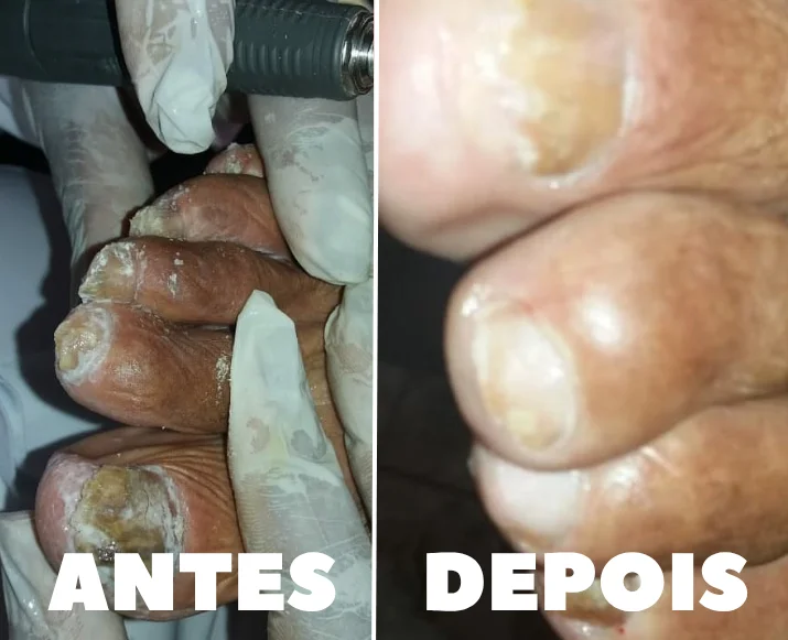 podologia geriátrica